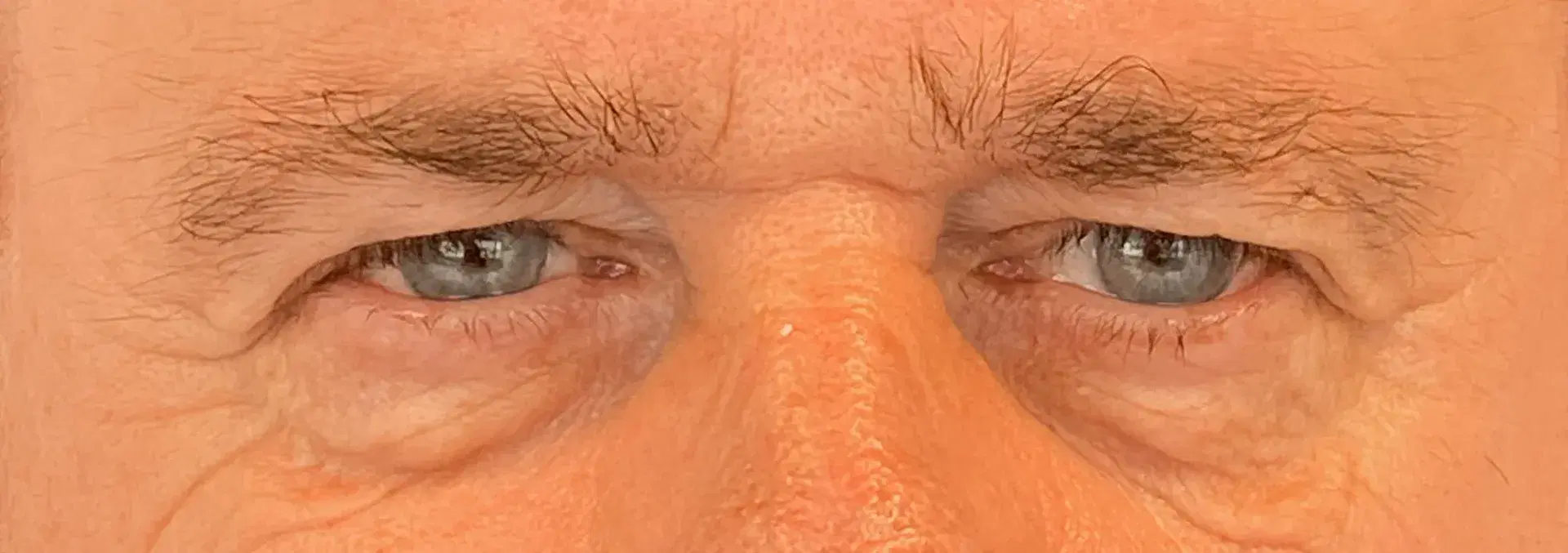 לפני אחרי-19