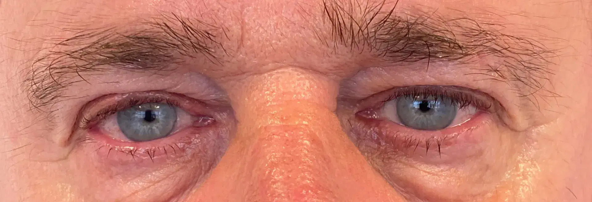 לפני אחרי-20